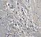 Kinesin Family Member 5A antibody, A03635, Boster Biological Technology, Immunohistochemistry paraffin image 