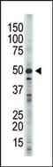 Glycogen Synthase Kinase 3 Beta antibody, AP15080PU-N, Origene, Western Blot image 