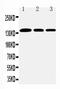 Collagen Type I Alpha 1 Chain antibody, LS-C343921, Lifespan Biosciences, Western Blot image 