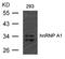 Heterogeneous Nuclear Ribonucleoprotein A1 antibody, 79-695, ProSci, Western Blot image 
