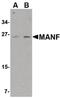Mesencephalic Astrocyte Derived Neurotrophic Factor antibody, PA5-20431, Invitrogen Antibodies, Western Blot image 