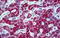Carbamoyl-Phosphate Synthase 1 antibody, MBS246349, MyBioSource, Immunohistochemistry paraffin image 