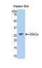 Glycine Decarboxylase antibody, LS-C294280, Lifespan Biosciences, Western Blot image 