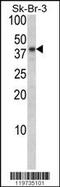 Biglycan antibody, 62-440, ProSci, Western Blot image 