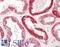 Activin A Receptor Type 1C antibody, LS-B13293, Lifespan Biosciences, Immunohistochemistry paraffin image 