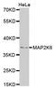 Mitogen-Activated Protein Kinase Kinase 6 antibody, LS-C332181, Lifespan Biosciences, Western Blot image 