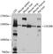Colony Stimulating Factor 2 Receptor Beta Common Subunit antibody, 13-691, ProSci, Western Blot image 