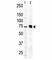 Protein Kinase C Beta antibody, F40137-0.4ML, NSJ Bioreagents, Western Blot image 