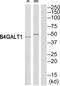 Beta-1,4-Galactosyltransferase 1 antibody, PA5-39057, Invitrogen Antibodies, Western Blot image 