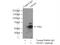 Ubiquitin Associated Protein 1 antibody, 12385-1-AP, Proteintech Group, Immunoprecipitation image 