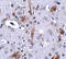 Tau Tubulin Kinase 1 antibody, 5013, ProSci, Immunohistochemistry frozen image 