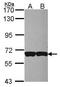 Adhesion G Protein-Coupled Receptor E5 antibody, GTX108192, GeneTex, Western Blot image 