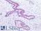 Poly(ADP-Ribose) Polymerase 1 antibody, LS-A11257, Lifespan Biosciences, Immunohistochemistry paraffin image 