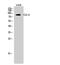 Chloride Voltage-Gated Channel 6 antibody, A07500, Boster Biological Technology, Western Blot image 