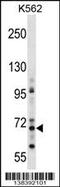 Zinc Finger Protein 256 antibody, 60-049, ProSci, Western Blot image 