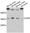 LIM Homeobox 8 antibody, STJ26197, St John