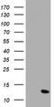 Migration And Invasion Enhancer 1 antibody, TA504609BM, Origene, Western Blot image 