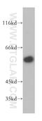 Raftlin Family Member 2 antibody, 17854-1-AP, Proteintech Group, Western Blot image 