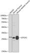 General Transcription Factor IIF Subunit 2 antibody, 15-024, ProSci, Western Blot image 