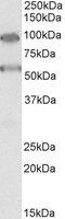 TBC1 Domain Family Member 9 antibody, MBS423365, MyBioSource, Western Blot image 