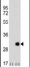 ETHE1 Persulfide Dioxygenase antibody, PA5-13594, Invitrogen Antibodies, Western Blot image 