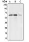 Aladin WD Repeat Nucleoporin antibody, MBS820890, MyBioSource, Western Blot image 