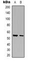 Glycerate Kinase antibody, LS-C368835, Lifespan Biosciences, Western Blot image 