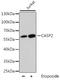Caspase 2 antibody, A5724, ABclonal Technology, Western Blot image 