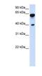 Dystrobrevin Beta antibody, NBP1-56492, Novus Biologicals, Western Blot image 