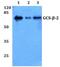 Guanylate cyclase soluble subunit beta-2 antibody, PA5-36523, Invitrogen Antibodies, Western Blot image 