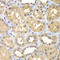 Ketohexokinase antibody, LS-C349140, Lifespan Biosciences, Immunohistochemistry frozen image 