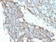 CD99 Molecule (Xg Blood Group) antibody, V2711IHC-7ML, NSJ Bioreagents, Immunohistochemistry paraffin image 