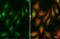 Bromodomain Containing 9 antibody, GTX636696, GeneTex, Immunocytochemistry image 