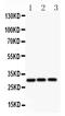 Activating Transcription Factor 1 antibody, PB9130, Boster Biological Technology, Western Blot image 