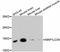 Microtubule Associated Protein 1 Light Chain 3 Alpha antibody, STJ113132, St John