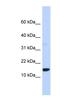 TPD52 Like 3 antibody, NBP1-56498, Novus Biologicals, Western Blot image 