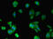 RAB10, Member RAS Oncogene Family antibody, LS-C316793, Lifespan Biosciences, Immunofluorescence image 