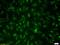 Interleukin 15 Receptor Subunit Alpha antibody, orb13495, Biorbyt, Immunocytochemistry image 