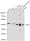 Inositol-Tetrakisphosphate 1-Kinase antibody, GTX33276, GeneTex, Western Blot image 