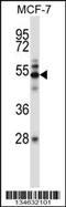 Mitogen-Activated Protein Kinase Kinase Kinase 7 antibody, MBS9204074, MyBioSource, Western Blot image 