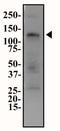 Ectonucleotide Pyrophosphatase/Phosphodiesterase 1 antibody, NB600-816, Novus Biologicals, Western Blot image 