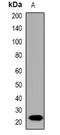 Interleukin 19 antibody, orb382631, Biorbyt, Western Blot image 