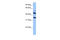 Interleukin 13 Receptor Subunit Alpha 2 antibody, 30-880, ProSci, Western Blot image 