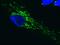 Succinate Dehydrogenase Complex Flavoprotein Subunit A antibody, ab14715, Abcam, Immunocytochemistry image 
