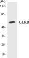 Glycine Receptor Beta antibody, LS-C291996, Lifespan Biosciences, Western Blot image 