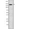 Sodium Voltage-Gated Channel Alpha Subunit 3 antibody, abx148677, Abbexa, Western Blot image 