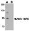 Zinc Finger CCCH-Type Containing 12B antibody, orb75392, Biorbyt, Western Blot image 