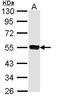 SS-A antibody, LS-C186316, Lifespan Biosciences, Western Blot image 