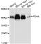 Pyruvate Dehydrogenase E1 Alpha 1 Subunit antibody, abx127000, Abbexa, Western Blot image 