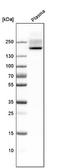 Complement Factor H antibody, NBP2-33933, Novus Biologicals, Western Blot image 